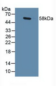 Polyclonal Antibody to GA Binding Protein Transcription Factor Alpha (GABPa)