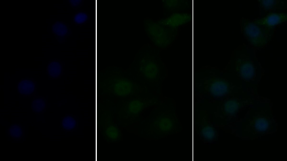 Polyclonal Antibody to TNF Receptor Associated Factor 6 (TRAF6)