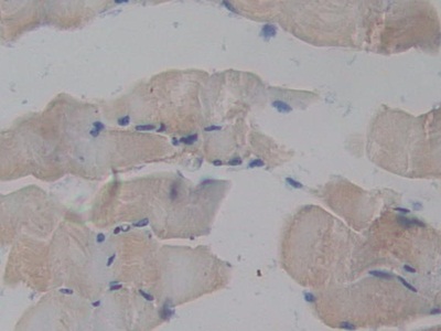 Polyclonal Antibody to TNF Receptor Associated Factor 2 (TRAF2)