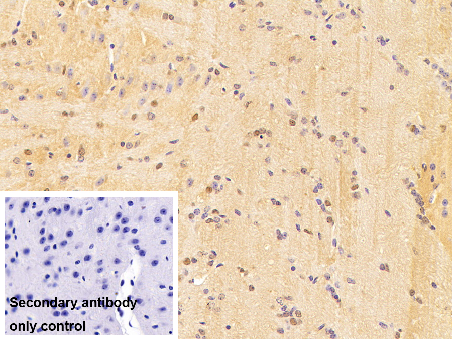 Polyclonal Antibody to Discs, Large Homolog 3 (DLG3)