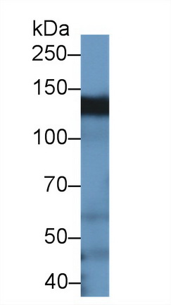 Polyclonal Antibody to Breast Cancer Anti-Estrogen Resistance 1 (BCAR1)