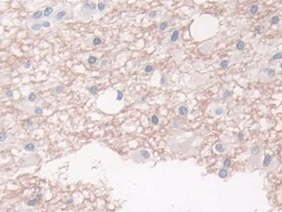 Polyclonal Antibody to Breast Cancer Anti-Estrogen Resistance 1 (BCAR1)