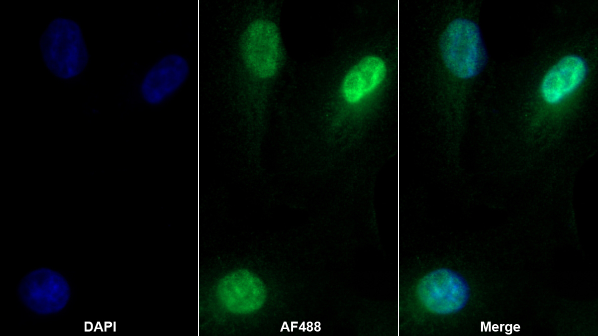 Polyclonal Antibody to Hepatocyte Nuclear Factor 1 Beta (HNF1b)