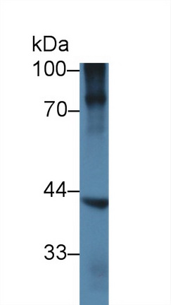 Polyclonal Antibody to NK6 Homeobox Protein 1 (NKX6-1)