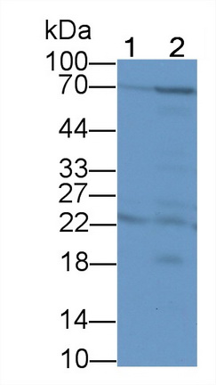 Polyclonal Antibody to Transcobalamin I (TCN1)