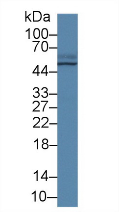 Polyclonal Antibody to Transcobalamin II, Macrocytic Anemia (TCN2)