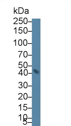 Polyclonal Antibody to Transcobalamin II, Macrocytic Anemia (TCN2)