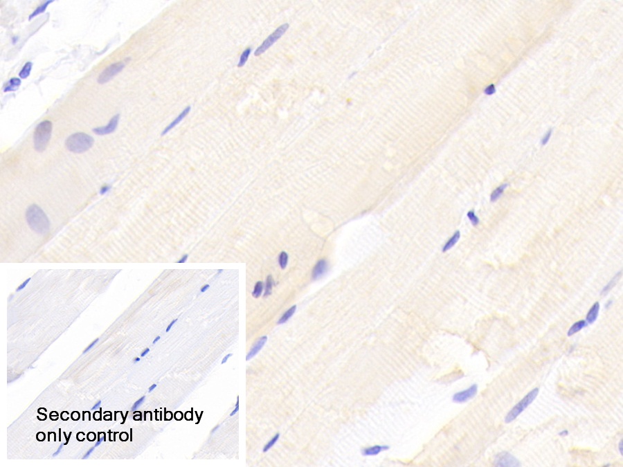 Polyclonal Antibody to Transcobalamin II, Macrocytic Anemia (TCN2)