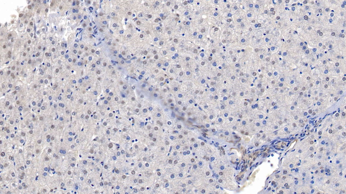 Polyclonal Antibody to Translocation Associated Notch Homolog 1 (TAN1)