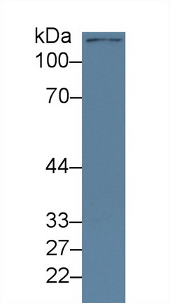 Polyclonal Antibody to Lysine Specific Demethylase 4A (KDM4A)