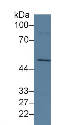 Polyclonal Antibody to Lysine Specific Demethylase 4A (KDM4A)