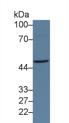 Polyclonal Antibody to Lysine Specific Demethylase 4A (KDM4A)