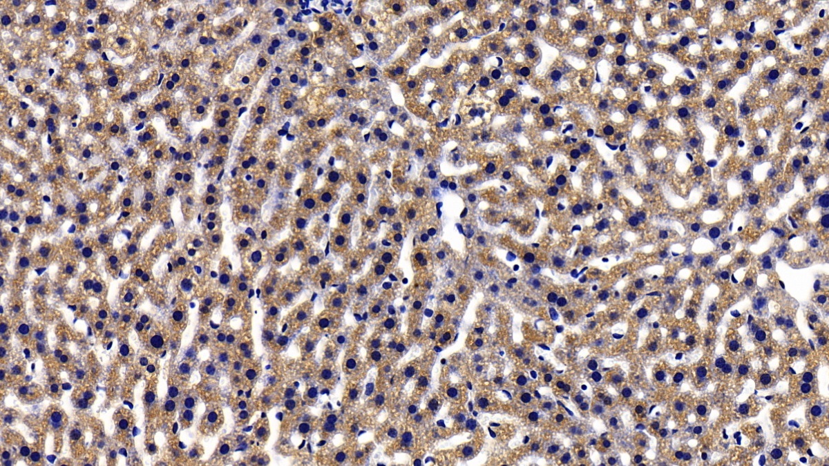 Polyclonal Antibody to Glycine-N-Methyltransferase (GNMT)