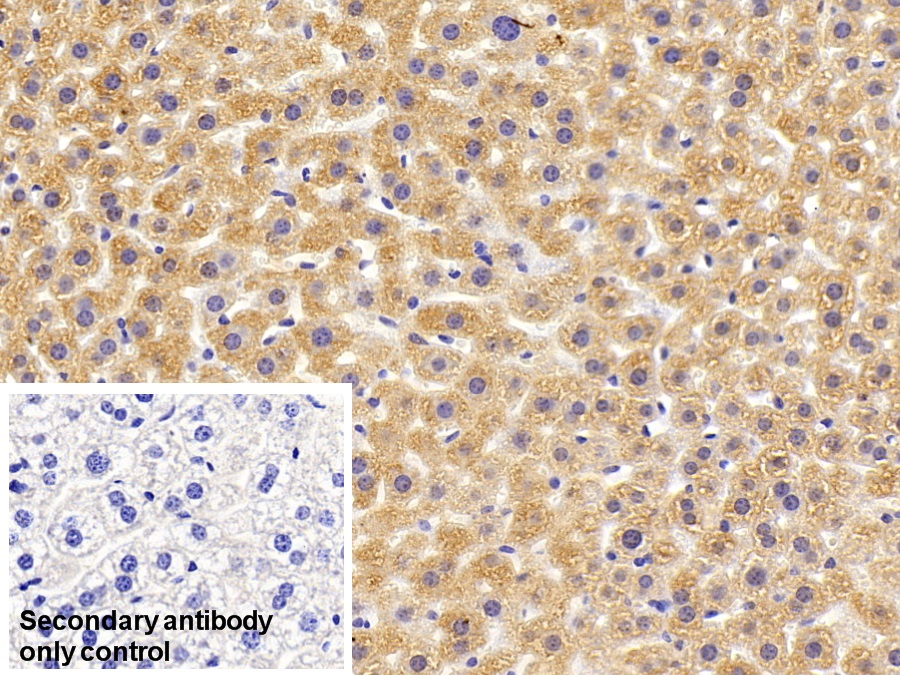 Polyclonal Antibody to Glycine-N-Methyltransferase (GNMT)