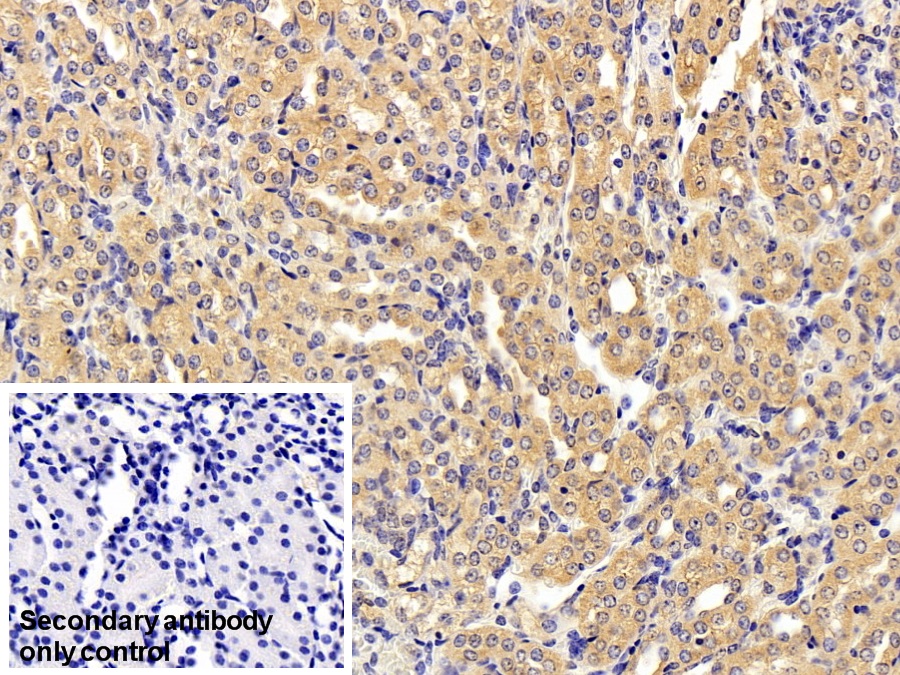 Polyclonal Antibody to Glycine-N-Methyltransferase (GNMT)