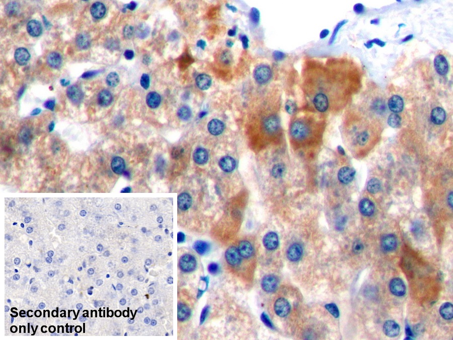 Polyclonal Antibody to Glycine-N-Methyltransferase (GNMT)