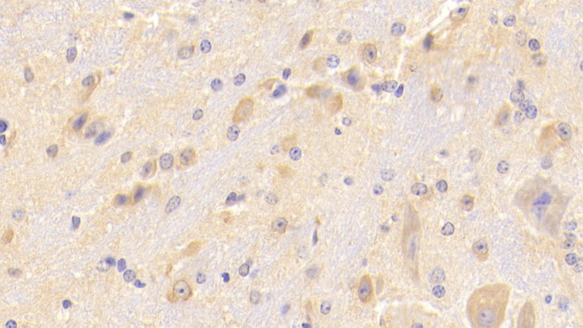 Polyclonal Antibody to Secretagogin (SCGN)