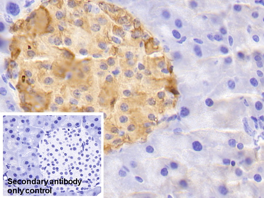 Polyclonal Antibody to Secretagogin (SCGN)