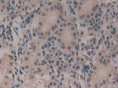 Polyclonal Antibody to Cold Inducible RNA Binding Protein (CIRBP)