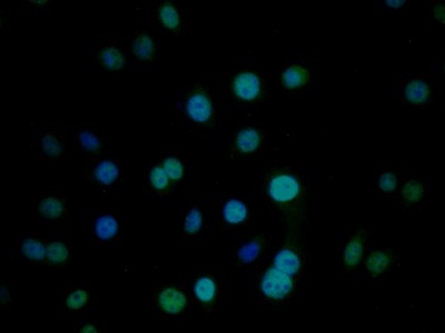 Polyclonal Antibody to Cold Inducible RNA Binding Protein (CIRBP)