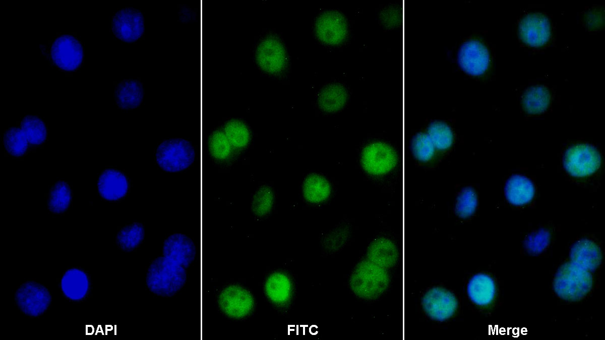 Polyclonal Antibody to Cold Inducible RNA Binding Protein (CIRBP)