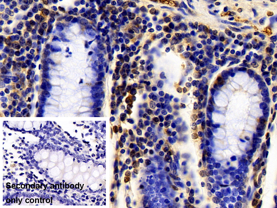 Polyclonal Antibody to Cold Inducible RNA Binding Protein (CIRBP)