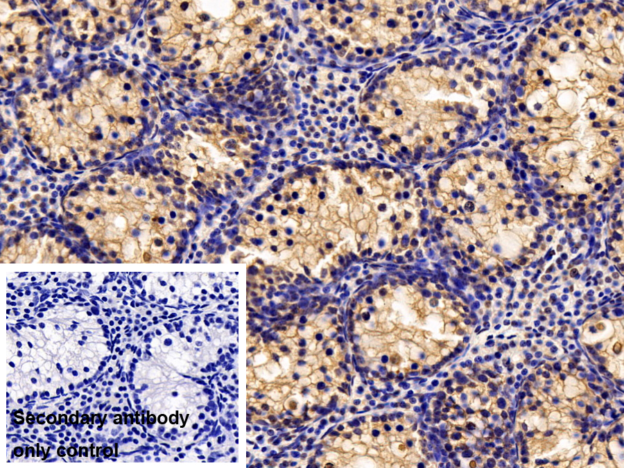 Polyclonal Antibody to Cold Inducible RNA Binding Protein (CIRBP)