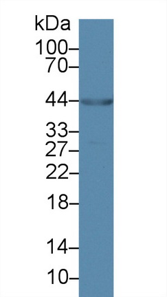 Polyclonal Antibody to Ankyrin Repeat Domain Protein 1 (ANKRD1)