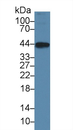 Polyclonal Antibody to Ankyrin Repeat Domain Protein 1 (ANKRD1)