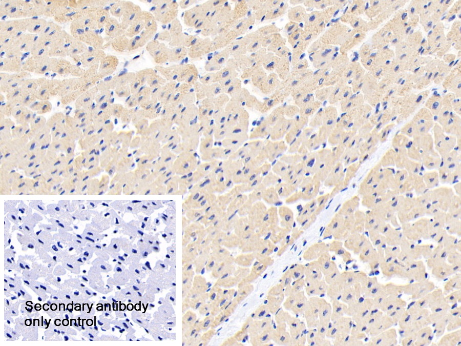 Polyclonal Antibody to Ankyrin Repeat Domain Protein 1 (ANKRD1)