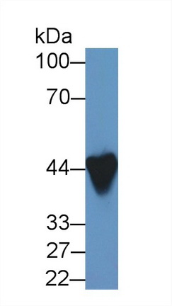 Polyclonal Antibody to Ankyrin Repeat Domain Protein 1 (ANKRD1)