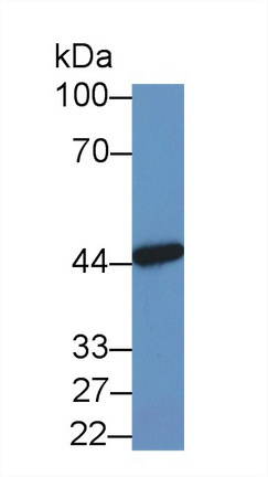 Polyclonal Antibody to Ankyrin Repeat Domain Protein 1 (ANKRD1)