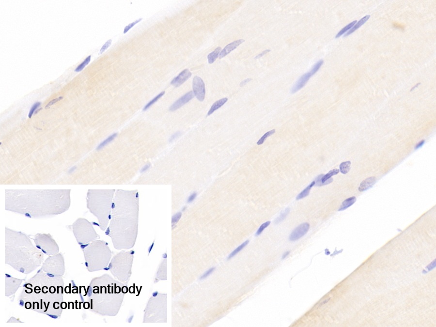 Polyclonal Antibody to Ankyrin Repeat Domain Protein 1 (ANKRD1)