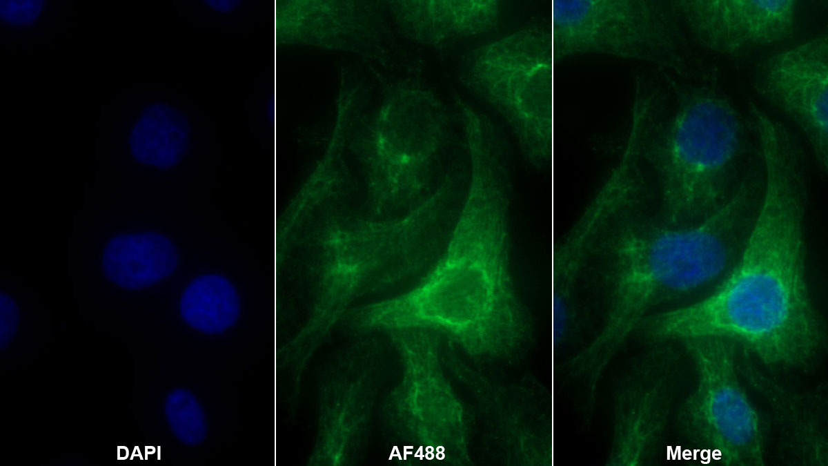 Polyclonal Antibody to Uromodulin (UMOD)