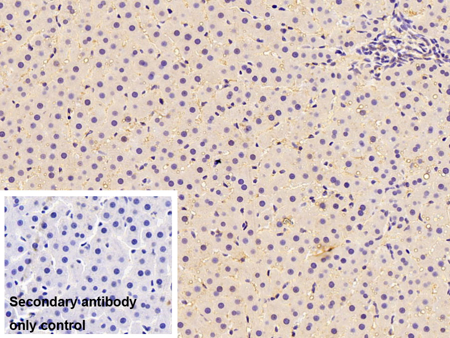 Polyclonal Antibody to UDP Glucuronosyltransferase 1 Family, Polypeptide A1 (UGT1A1)