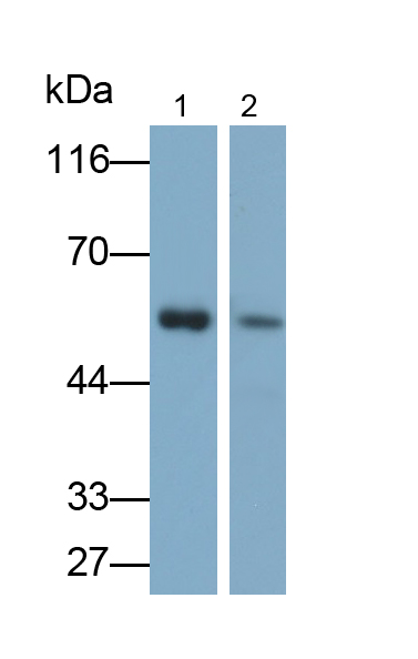 Polyclonal Antibody to UDP Glucuronosyltransferase 1 Family, Polypeptide A1 (UGT1A1)