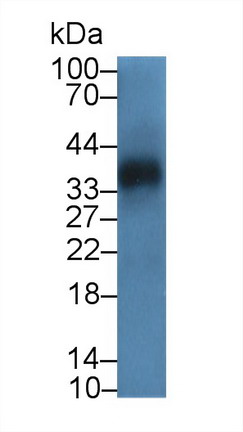 Polyclonal Antibody to Ubiquitin Carboxyl Terminal Hydrolase L5 (UCHL5)