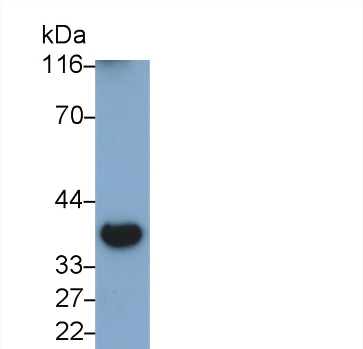 Polyclonal Antibody to Ubiquitin Carboxyl Terminal Hydrolase L5 (UCHL5)