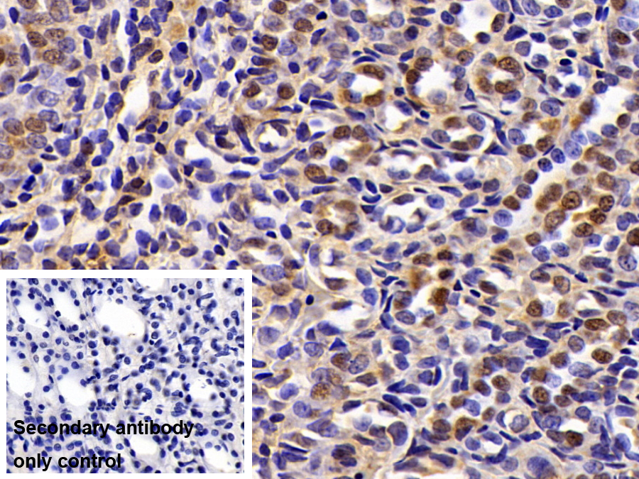 Polyclonal Antibody to Ubiquitin Carboxyl Terminal Hydrolase L3 (UCHL3)