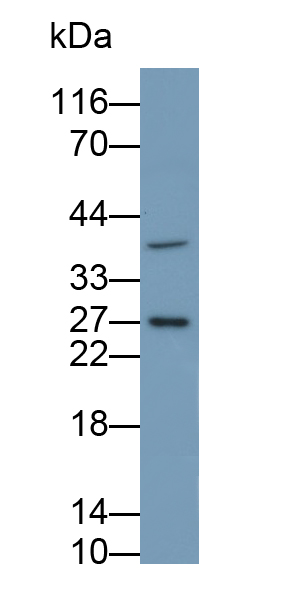 Polyclonal Antibody to Ubiquitin Carboxyl Terminal Hydrolase L3 (UCHL3)