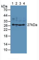 Polyclonal Antibody to Ubiquitin Carboxyl Terminal Hydrolase L1 (UCHL1)