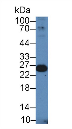 Polyclonal Antibody to Ubiquitin Carboxyl Terminal Hydrolase L1 (UCHL1)