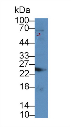 Polyclonal Antibody to Ubiquitin Carboxyl Terminal Hydrolase L1 (UCHL1)