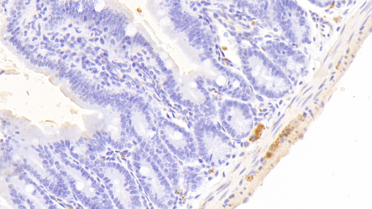 Polyclonal Antibody to Ubiquitin Carboxyl Terminal Hydrolase L1 (UCHL1)