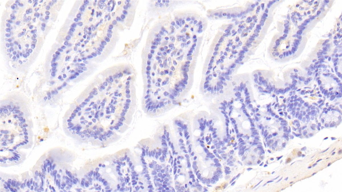 Polyclonal Antibody to Ubiquitin Carboxyl Terminal Hydrolase L1 (UCHL1)