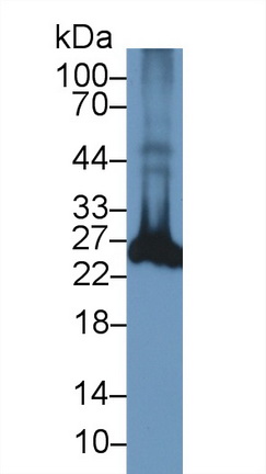 Polyclonal Antibody to Ubiquitin Carboxyl Terminal Hydrolase L1 (UCHL1)