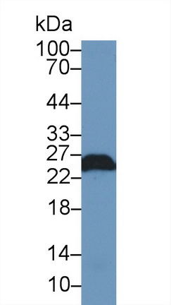 Polyclonal Antibody to Ubiquitin Carboxyl Terminal Hydrolase L1 (UCHL1)