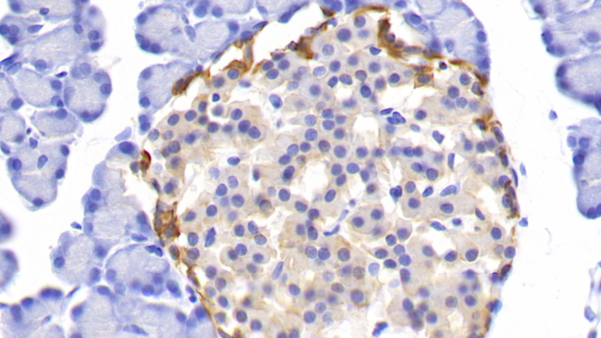 Polyclonal Antibody to Ubiquitin Carboxyl Terminal Hydrolase L1 (UCHL1)