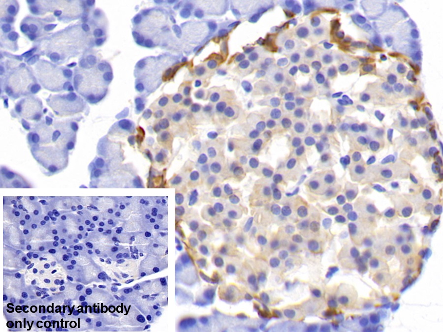 Polyclonal Antibody to Ubiquitin Carboxyl Terminal Hydrolase L1 (UCHL1)