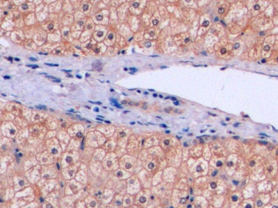 Polyclonal Antibody to Thymidylate Synthetase (TYMS)